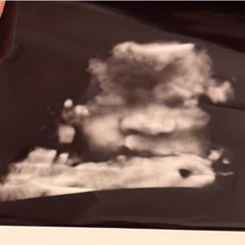 Baby Necessities Fund