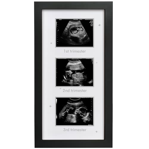 HAMUIERS Ultrasound Picture Frame - Triple Sonogram Frame for Mom to Be | Pregnancy Photo Album Decor | Baby Nursery Essentials & Gender Reveal Gifts | First Trimester Keepsake & Pregnancy Must Haves - Black2