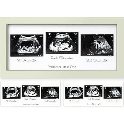 KeaBabies Baby Sonogram Picture Frames - Trio Ultrasound Picture Frames, First Time Mom Gift, Cute Pregnancy Reveal Photo Frame, Baby Gender Reveal Gift, Newborn Nursery Decor (Sage)