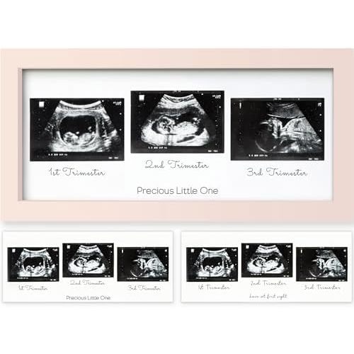 KeaBabies Baby Sonogram Picture Frames,Trio Ultrasound Photo (Petal Pink)