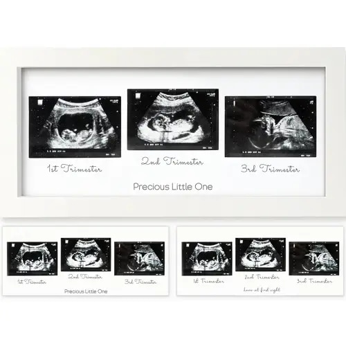 KeaBabies Baby Sonogram Picture Frames - Trio Ultrasound Picture Frames, First Time Mom Gift, Cute Pregnancy Reveal Photo Frame, Baby Gender Reveal Gift, Newborn Nursery Decor (Alpine White)