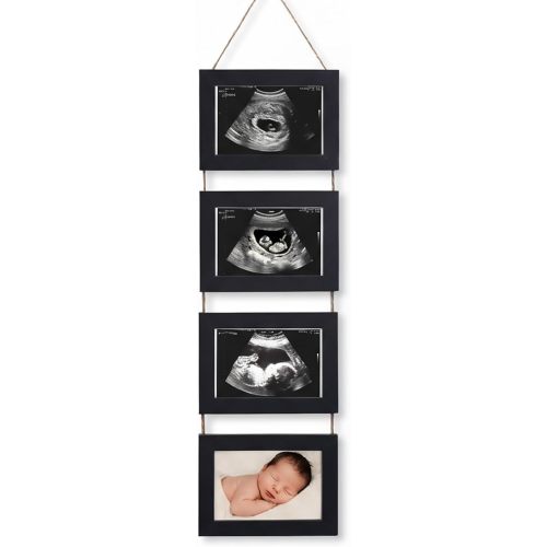 4-in-1 Sonogram Picture Frame, Display Pregnancy Keepsake Album for Pregnancy Announcements, Gender Reveal, and Newborn Photos, Perfect Gender-Neutral Nursery Decor, First Time Mom Gift, Black