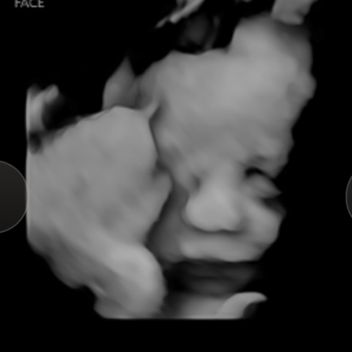 Babylist Cash Fund