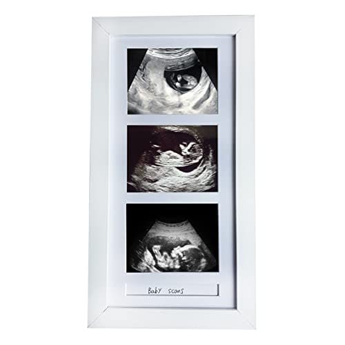 Pine Wood Triple Ultrasound Frame, 3 Sonogram Photos, White | Holds 3 Sonogram Photos, Pregnancy Announcement, First-Time Mom Gift, White, Baby Keepsake, Ultrasound Photo Album