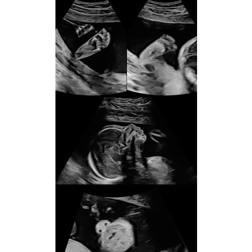 Car Seat & Stroller Fund