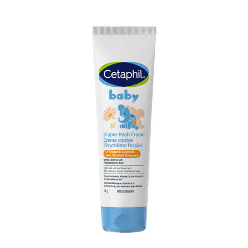 Cetaphil Baby Diaper Rash Cream with Organic Calendula 70g | Helps Treat and Heal Diaper Rash | Hypoallergenic | Paraben, Fragrance and Steroid Free | Pediatriciation Recommended - Walmart.ca