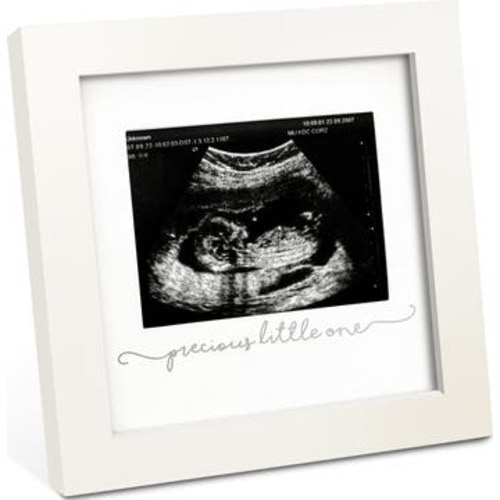 Solo Baby Sonogram Frame
