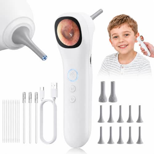 Otoscope Ear Camera with 1.21” Screen, 1080P Ear Scope with 4 LED Lights, Otoscope Camera for Adults, Support Photo & Video, Type-C Charging with Computers, Baby Essentials, Home Medical