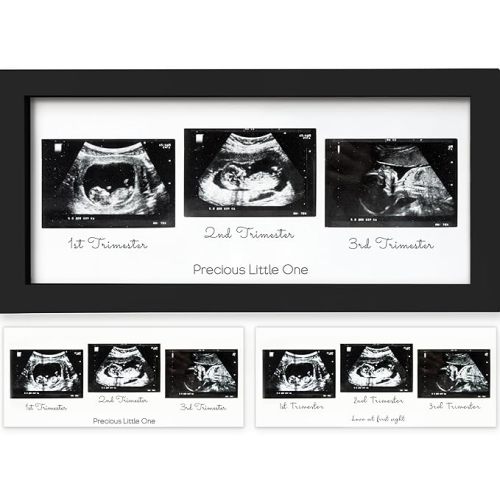 Baby Sonogram Picture Frames - Trio Ultrasound Picture Frame, First Time Mom Gift, Cute Pregnancy Reveal Photo Frame, Baby Gender Reveal & Mother's Day, Newborn Nursery Decor (Onyx Black)