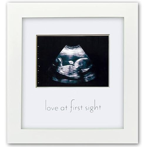 Green Pollywog Sonogram Picture Frame, White Ultrasound Display