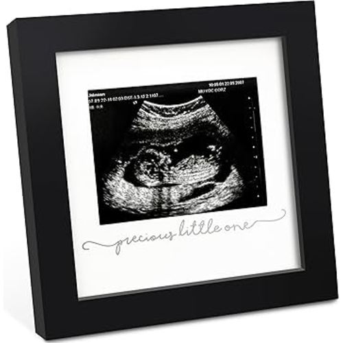 KeaBabies Baby Sonogram Picture Frame - Modern Ultrasound Picture Frames for Mom to Be, First Pregnancy Gifts for Expecting Mom & First Time Dad, Baby Gender Reveal Gifts (Onyx Black)