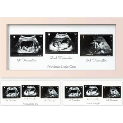 Trio Baby Sonogram Frame