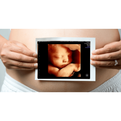 Bambini Signature (24+ Weeks)+Free Redo | Bambini Ultrasound Studio