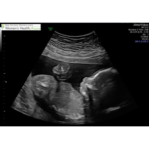 Diapers and wipes