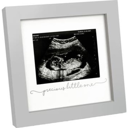 Solo Baby Sonogram Frame