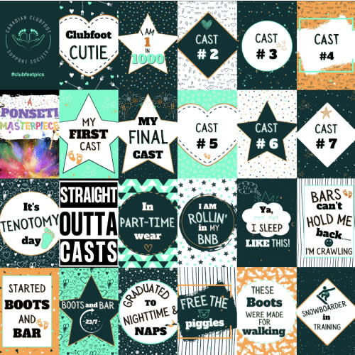 Luxe Printed Clubfoot Treatment Milestone Cards