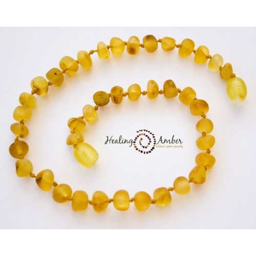 Healing Amber Baltic Amber Anklet/Bracelet