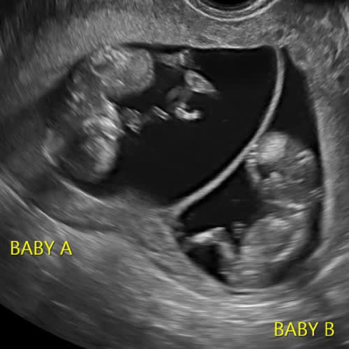 Babylist Childcare Fund