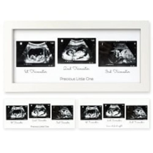 Sonogram Picture Frame - Trio Ultrasound Picture Frames For Mom To Be Gift - Baby Ultrasound frame - Pregnancy Announcements Sonogram frame - Baby Nursery Decor, Pregnant Mom Gifts(Alpine White)