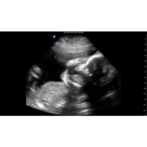 Newborn family photos