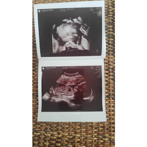 Baby V