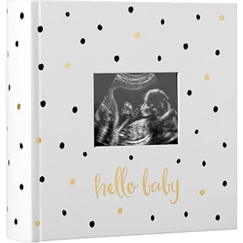 Pearhead Hello Baby Photo Album, Keepsake Book for New and Expecting Parents, Gender-Neutral Baby Accessory, Ideal Gift for Baby Shower, Holds 200 Pictures, Black and Gold Polka Dot