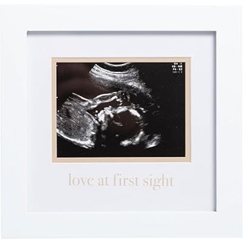 Pearhead Love At First Sight Sonogram Frame, Ultrasound Picture Frame, Pregnancy Announcement Photo Frame, Baby Keepsake Gift For Expecting Parents