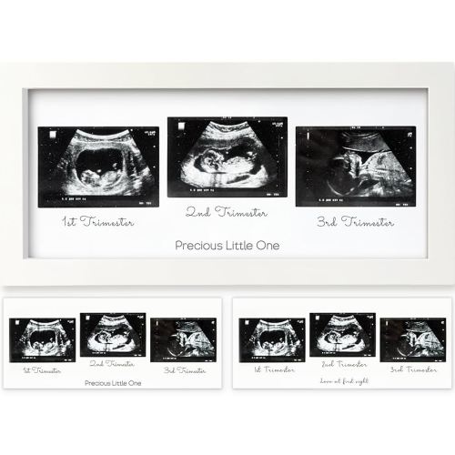 KeaBabies Baby Sonogram Picture Frames - Trio Ultrasound Picture Frames, First Time Mom Gift, Cute Pregnancy Reveal Photo Frame, Baby Gender Reveal Gift, Newborn Nursery Decor (Alpine White)