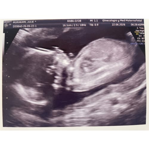 Baby Murakami Fund