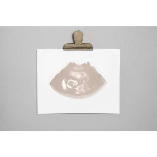 DOVE Ultrasound, Sonogram, Physical Print