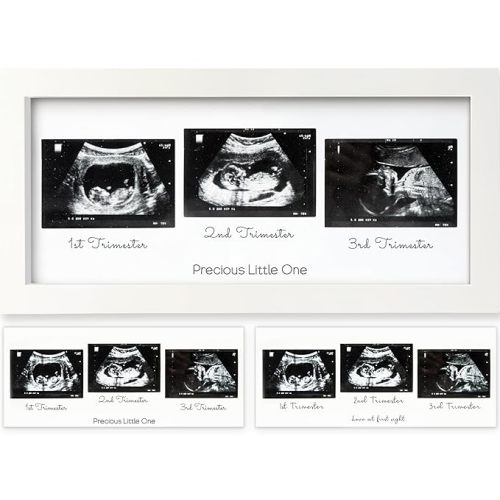 Baby Sonogram Picture Frames - Trio Ultrasound Picture Frame, First Time Mom Gift, Cute Pregnancy Reveal Photo Frame, Baby Gender Reveal & Mother's Day, Newborn Nursery Decor (Alpine White)