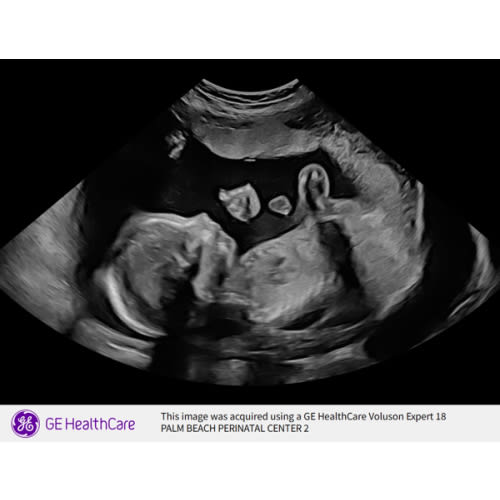 Diaper and supply fund