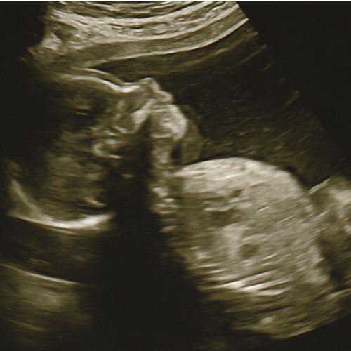 2026 Baby | Walmart.com