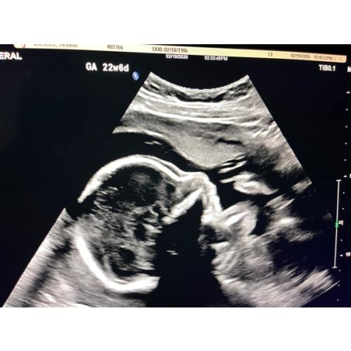Birth Plan Template | How To Write A Perfect Labor & Delivery Plan