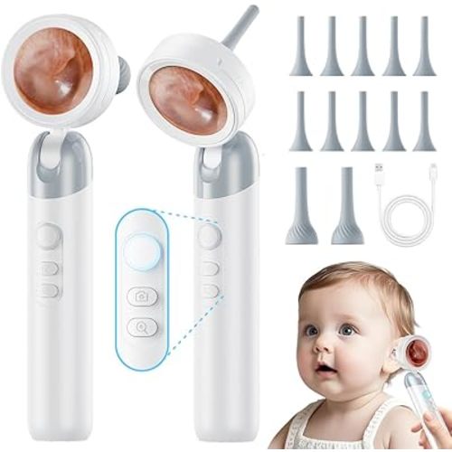 Otoscope Ear Camera with Light, 1.4” Screen 1080P HD Ear Scope, 12 Silicone Specula Tips, Photo & Video Recording, Type-C Rechargeable, Ear Cleaning Camera for Adult Kid and Pet