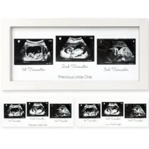 KeaBabies Wooden Picture Frame 3-Pack - Wood & Glass Baby Sonogram Frames, Gender Reveal Party Decor, First-Time Mom Gift, Wall/Shelf/Desk Desk-to-Wall Display, Newborn Nursery Decoration - TikTok Shop
