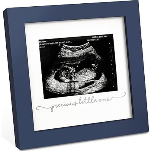 KeaBabies Baby Sonogram Picture Frame - Modern Ultrasound Picture Frames for Mom to Be, First Pregnancy Gifts for Expecting Mom & First Time Dad, Baby Gender Reveal Gifts (Midnight Blue)