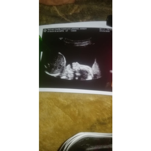Baby