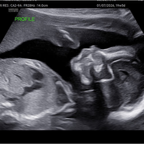 Stroller & Diaper Fund