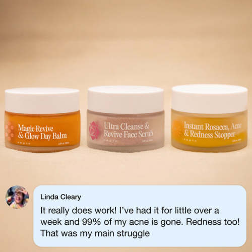 The Complete Acne System for Women | Frøya Organics