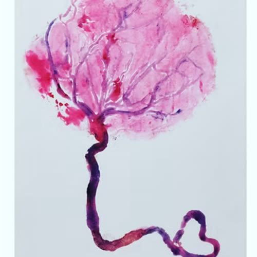 Nationwide | Lancaster Placenta | United States