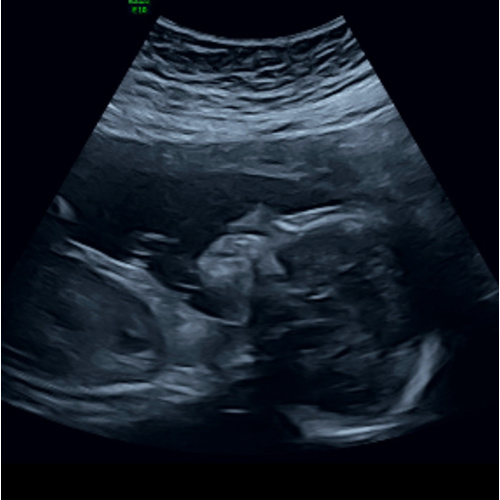 Amazon: Baby Registry