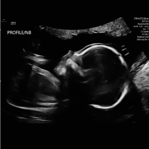 Babylist Parental Leave Fund