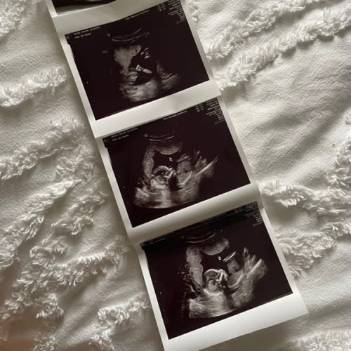 Gender-Specific / Personalization Fund