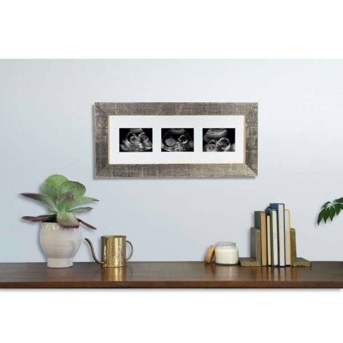 Sonogram Picture Frame |Baby Ultrasound Trimester Progression Keepsake Photo Frame | Pregnancy Milestone 3 Opening Frame for Mom to Be