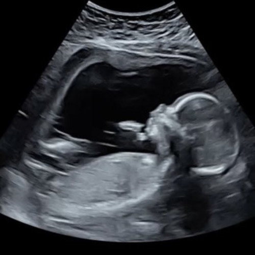 Desirae Linton and Michael Taylor’s Baby Registry at Babylist