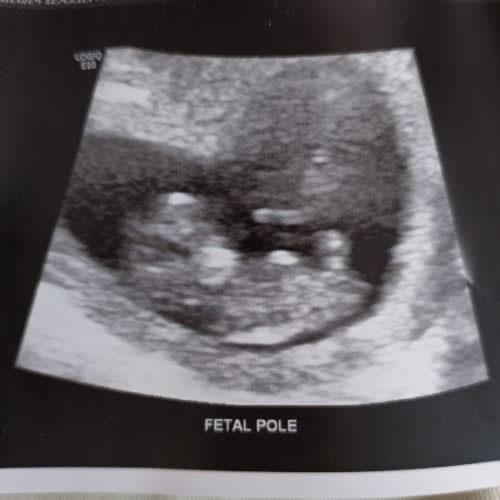 Baby Martin Cash Fund