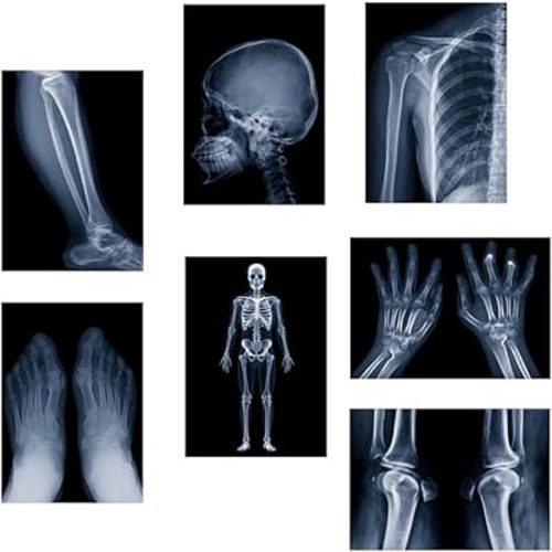 X-ray Science Education Package for Human Anatomy and Bone Parts is Suitable for Light Table and lamp Fittings.