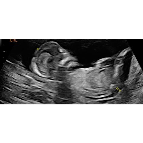 Babylist Shop Gift Card