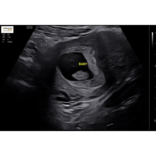 Babylist Cash Fund